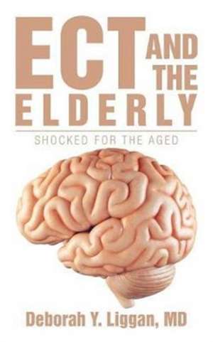 ECT AND THE ELDERLY de Md Deborah Y. Liggan