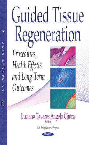 Guided Tissue Regeneration: Procedures, Health Effects & Long-Term Outcomes de Luciano Tavares Angelo Cintra