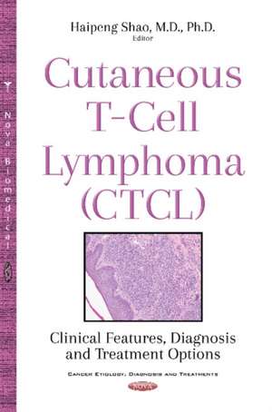 Cutaneous T-Cell Lymphoma (CTCL): Clinical Features, Diagnosis & Treatment Options de Haipeng Shao MD, Ph.D.