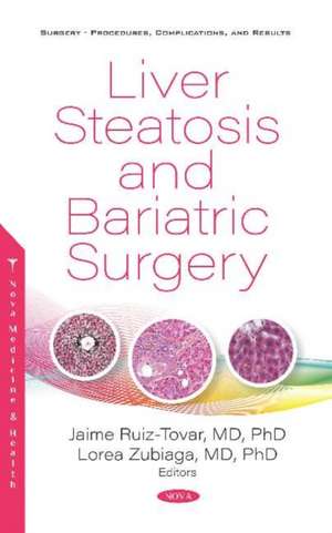 Liver Steatosis and Bariatric Surgery de Lorea Zubiaga