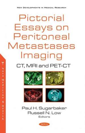 Sugarbaker, P: Pictorial Essays on Peritoneal Metastases Ima