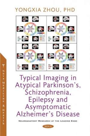 Zhou, Y: Typical Imaging in Atypical Parkinson's, Schizophre de Yongxia Zhou