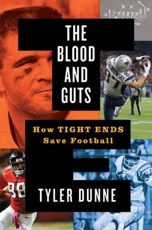 The Blood and Guts de Tyler Dunne