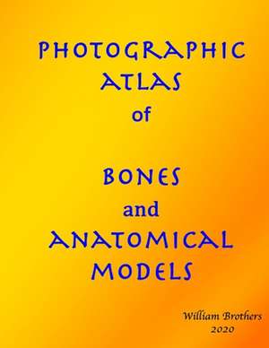 Photographic Atlas of Bones and Anatomical Models de Brothers, MR William