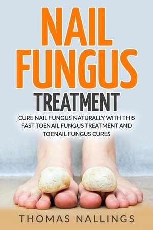 Nail Fungus Treatment de Nallings, Thomas