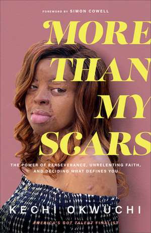 More Than My Scars – The Power of Perseverance, Unrelenting Faith, and Deciding What Defines You de Kechi Okwuchi