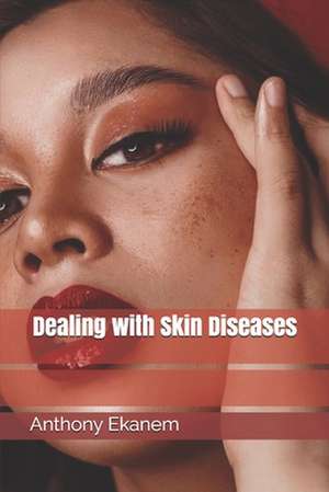 Dealing with Skin Diseases de Anthony Ekanem