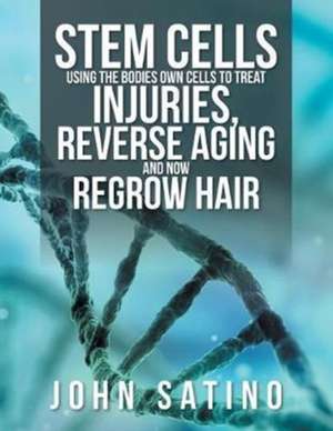 Stem Cells Using the Bodies Own Cells to Treat Injuries, Reverse Aging and Now Regrow Hair de John Satino