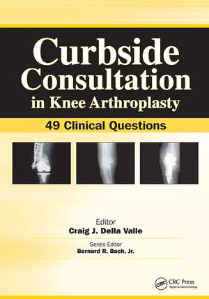 Curbside Consultation in Knee Arthroplasty: 49 Clinical Questions de Craig Della Valle