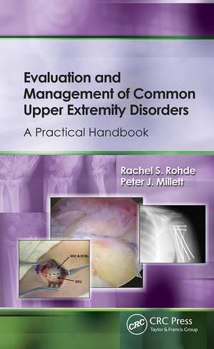 Evaluation and Management of Common Upper Extremity Disorders: A Practical Handbook de Rachel Rohde