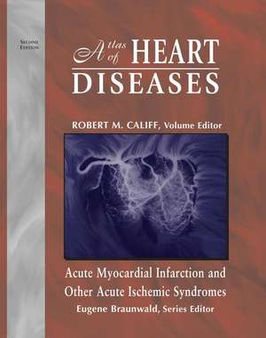 Atlas of Heart Diseases: Acute Myocardial Infarction and Other Acute Ischemic Syndromes de Eugene Braunwald