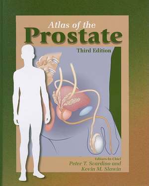 Atlas of the Prostate de C. Downing