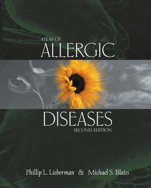 Atlas of Allergic Diseases de J. McCullough