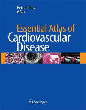 Essential Atlas of Cardiovascular Disease de Peter Libby