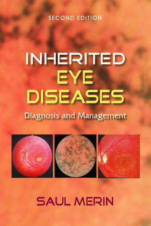 Inherited Eye Diseases: Diagnosis and Management de Saul Merin