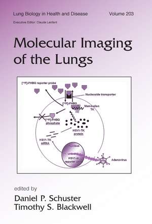 Molecular Imaging of the Lungs de Daniel Schuster