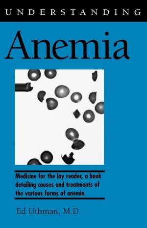 Understanding Anemia de Ed Uthman