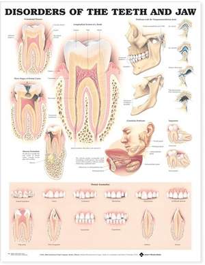 Disorders of the Teeth and Jaw Anatomical Chart de Anatomical Chart Company