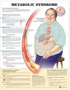 Metabolic Syndrome Anatomical Chart de Anatomical Chart Company