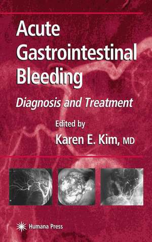 Acute Gastrointestinal Bleeding: Diagnosis and Treatment de Karen E. Kim