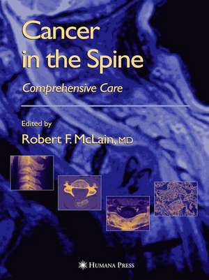 Cancer in the Spine: Comprehensive Care de Robert F. McLain