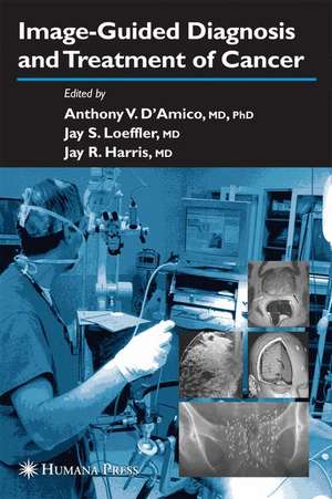 Image-Guided Diagnosis and Treatment of Cancer de Anthony V. D’Amico