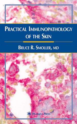 Practical Immunopathology of the Skin de Bruce R. Smoller