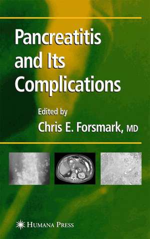 Pancreatitis and Its Complications de Chris E. Forsmark