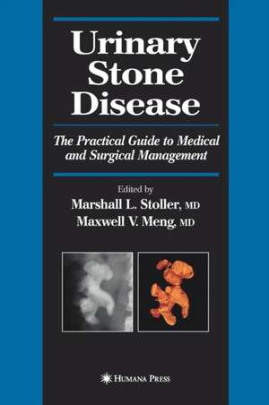 Urinary Stone Disease: The Practical Guide to Medical and Surgical Management de Marshall L. Stoller