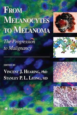 From Melanocytes to Melanoma: The Progression to Malignancy de Vincent J. Hearing