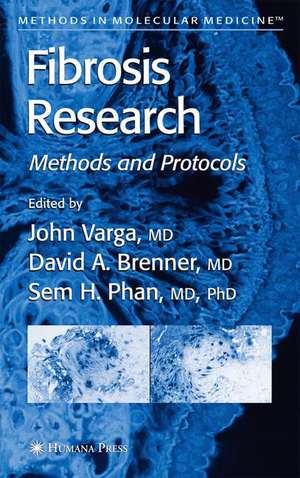 Fibrosis Research: Methods and Protocols de John Varga