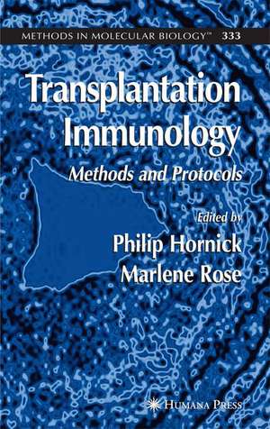 Transplantation Immunology: Methods and Protocols de Philip Hornick