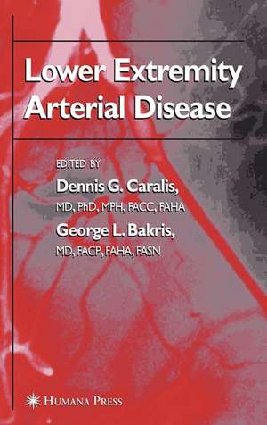 Lower Extremity Arterial Disease de Dennis G. Caralis