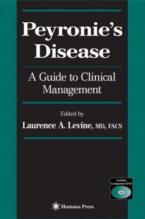 Peyronie's Disease: A Guide to Clinical Management de Laurence A. Levine