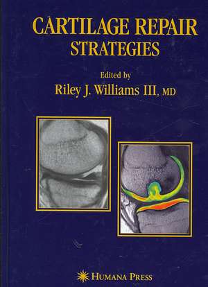 Cartilage Repair Strategies de Riley J. Williams