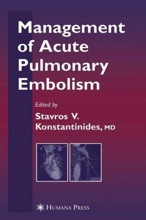 Management of Acute Pulmonary Embolism de Stavros V. Konstantinides