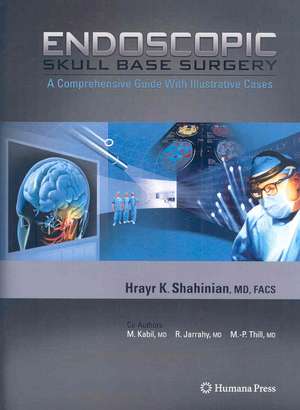 Endoscopic Skull Base Surgery: A Comprehensive Guide with Illustrative Cases de Hrayr K. Shahinian