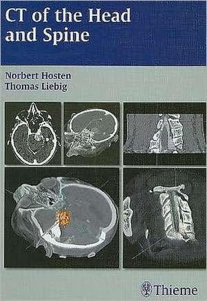 CT of the Head and Spine de Norbert Hosten