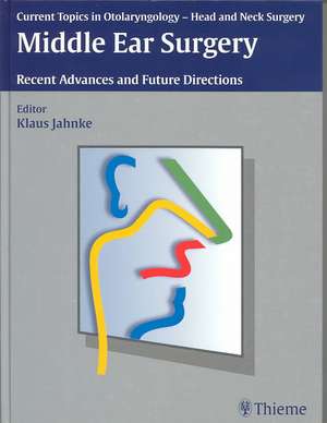 Middle Ear Surgery de Klaus Jahnke