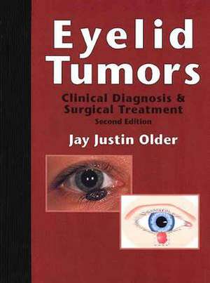 Eyelid Tumors: Clinical Diagnosis and Surgical Treatment de Jay Justin Older