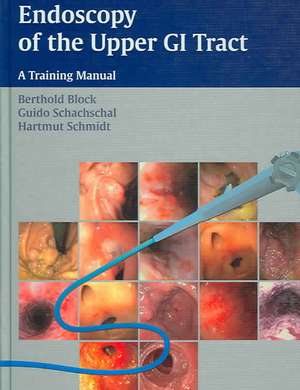 Endoscopy of the Upper GI Tract: A Training Manual de Berthold Block