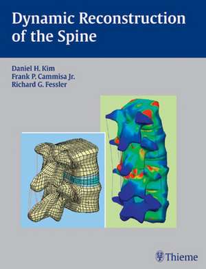 Dynamic Reconstruction of the Spine de Daniel H. Kim