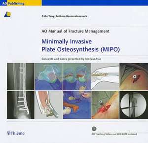 Minimally Invasive Plate Osteosynthesis (MIPO): Concepts and cases presented by the AO East Asia de G On Tong