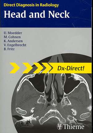 Head and Neck Imaging de Ulrich Moedder