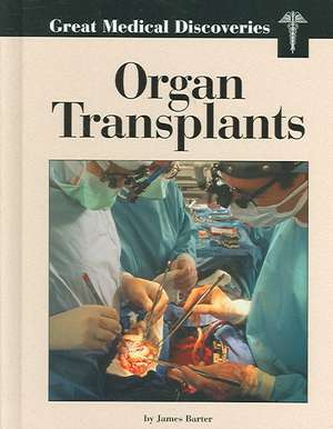 Organ Transplants de James Barter