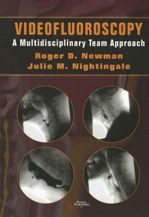 Videofluoroscopy de Julie M. Nightingale