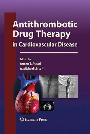 Antithrombotic Drug Therapy in Cardiovascular Disease de Arman T. Askari