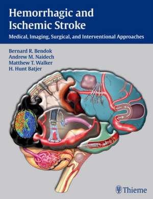 Hemorrhagic and Ischemic Stroke de B Bendok