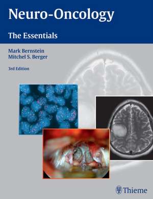 Neuro-Oncology: The Essentials de Mark Bernstein