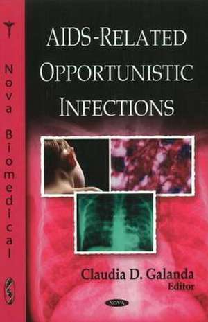 AIDS-Related Opportunistic Infections de Claudia D. Galanda